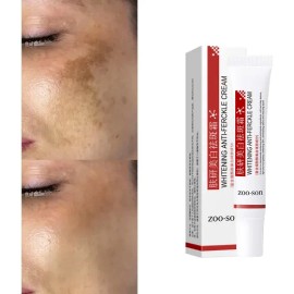 Crema Iluminadora Facial, Difumina Las Manchas, Unifica La P Todo Tipo De Piel Día/noche