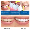 JRYXDS Pack of 4 Tartar Removal Teeth Whitening Tartar Removal