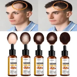 LEWEDO 5X Organic Batana Oil Serum for Hair Growth Improves Scalp Health Anti-Hair Loss