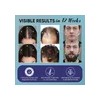 2026 Aa. Tratamiento Para El Crecimiento Del Cabello