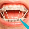 30 bandas elásticas dentales multicolor para tirantes, de plástico, desechables,