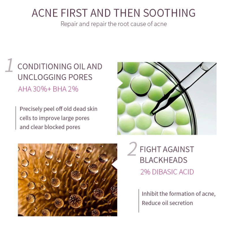 AHA 30% + BHA 2% Peeling Solution, Chemical Peel for