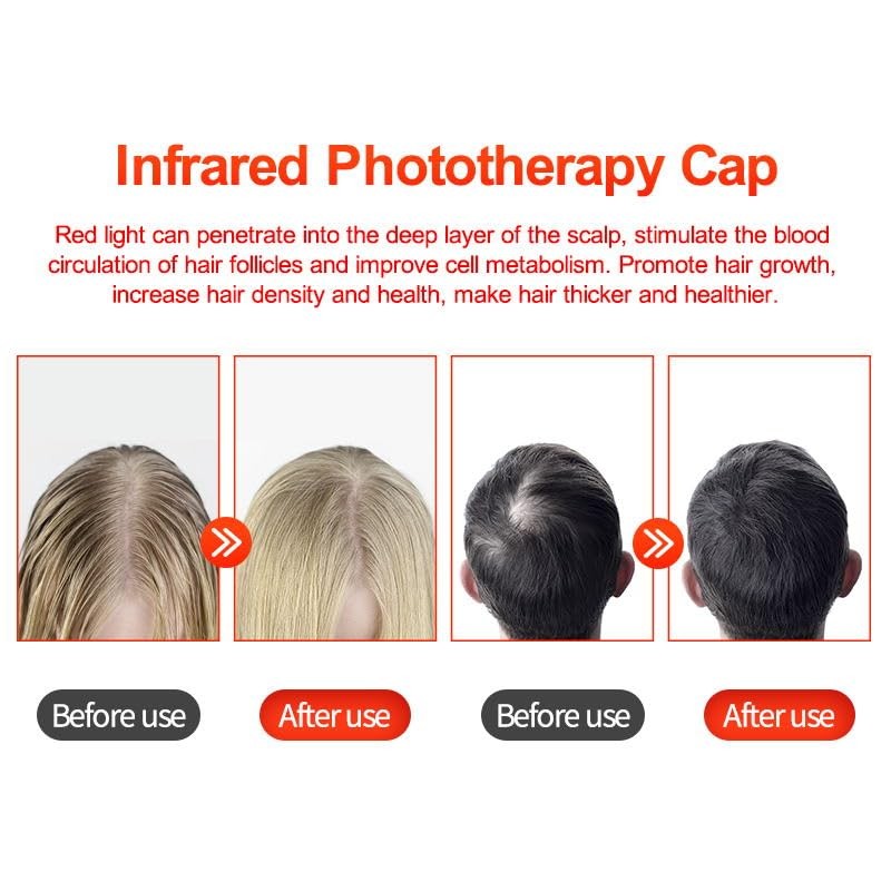 Gorro Crecimiento Cabello Terapia Luz Roja Ajuste Tres Niveles Pulso