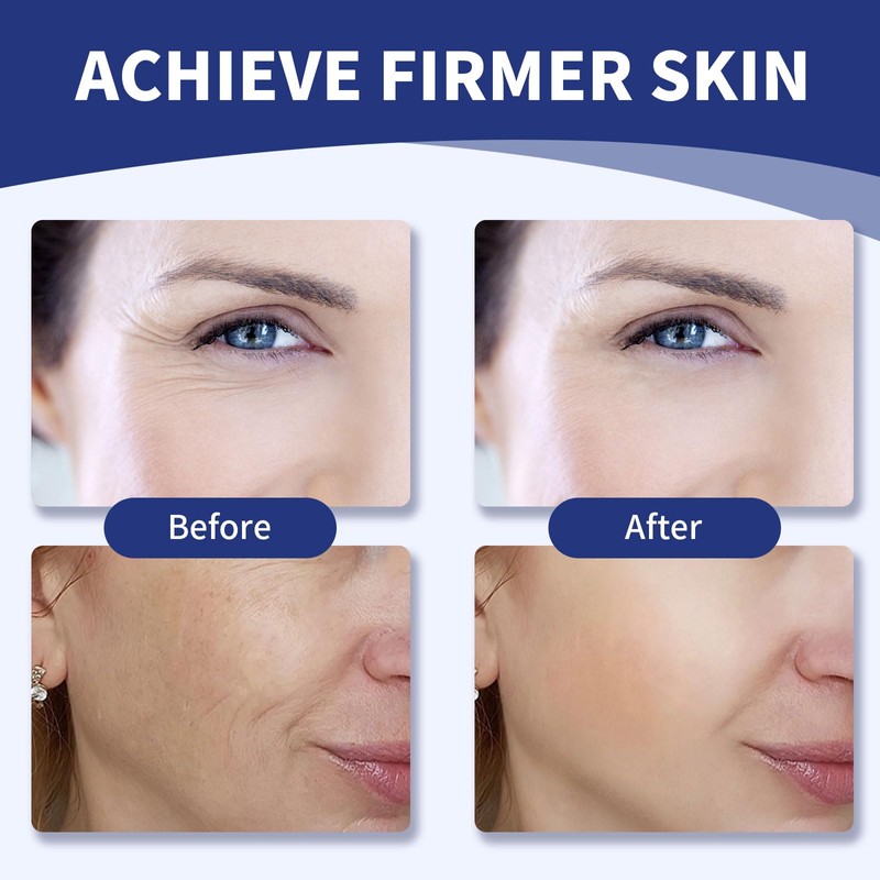 100% Volufiline Serum Skincare, Wrinkle Lifting and Firming Serum-Improve Fine