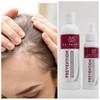 Hairmony Prevention Professional Revitalizing Hair Treatment Shampoo 8 Fl oz
