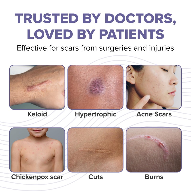 Pro-SIL Kids 4.25g – Mess-Free, Glide-On Silicone Stick for Kids