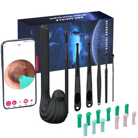 SpringBreak Earwax Removal Tool Set with Camera - Portable 360¬∞ Wide Angle Ear Cleaner with Type-C Rechargeable, Waterproof Endoscope Ear Cleaning Tool for iPhone and Android Phones, Christmas Gift, Winter Gift Set, New Year Gift, Stocking Fillers:_Black-B