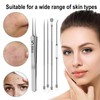 tiyiyok Pack of 5 Comedone Squeezers, Blackhead Remover, Pimple Remover,