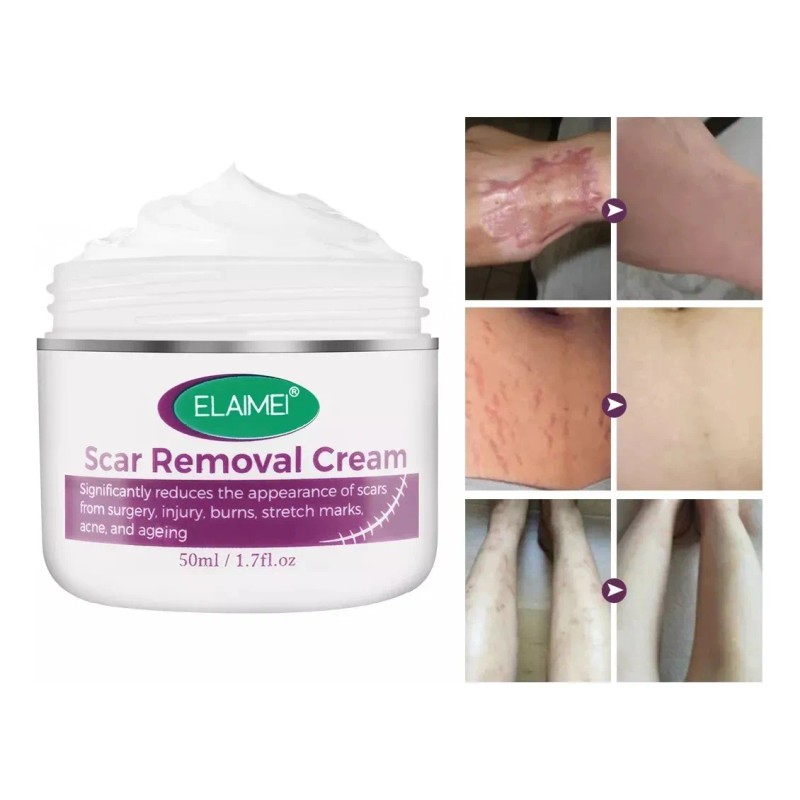 Kit Cicatrices Cirugías Cesárea Crema Y Parche Silicón