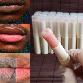 N.A.S.E 2PCS Lips Pink Fresh Lightening Bleaching Cream Treatment Remove Dark Smoke Lips Lips Bleaching whitening Essence Lip Balm (pink), 2 Count (Pack of 1)