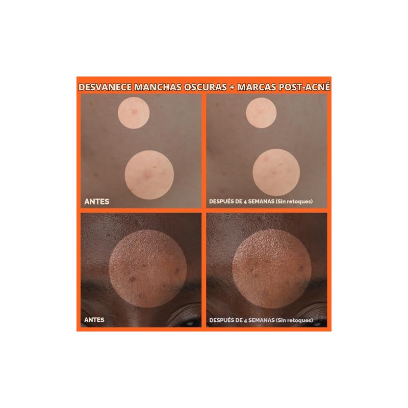 Innisfree Crema Iluminadora Enzima Verde Hidratante Facial Coreana Manchas Oscuras