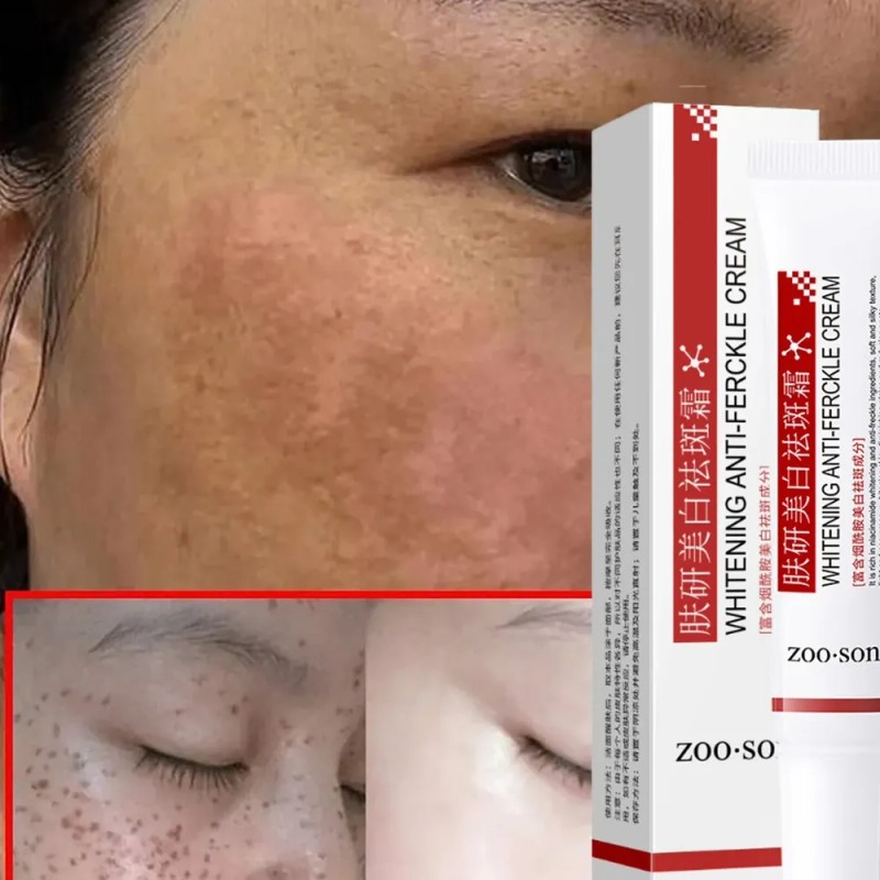 Crema Despigmentante Anti Manchas Zoo·son 20g