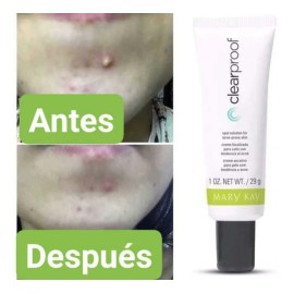 Crema Focalizada Cutis Tendencia Acné Mary Kay Grasa