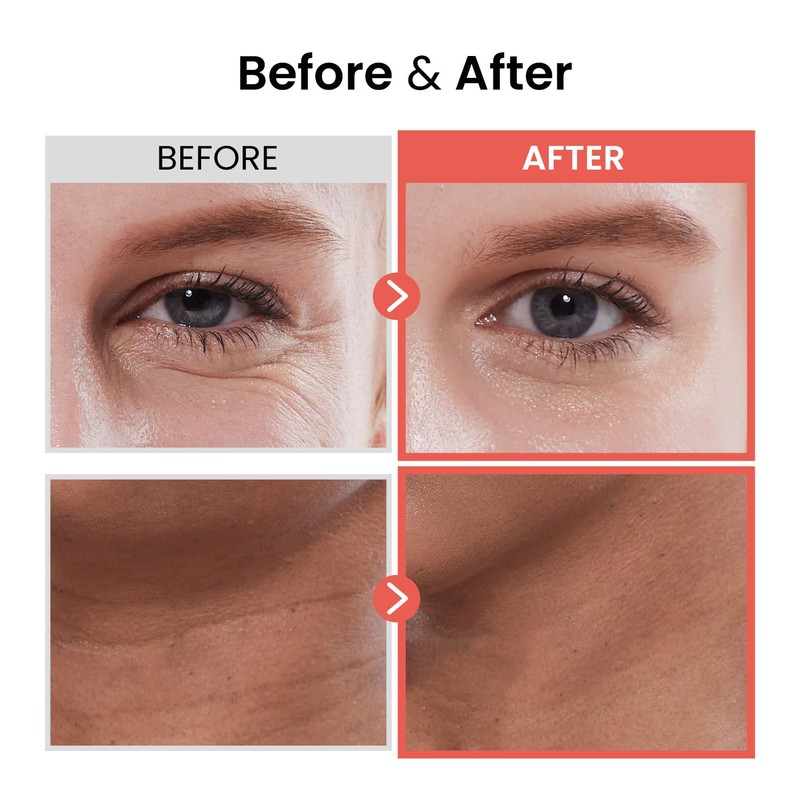 THE SKIN HOUSE Wrinkle Supreme Serum – Red Ginseng &