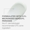 Neutrogena Stubborn Acne AM Face Treatment with 2.5% Micronized Benzoyl