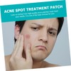 FOMIYES Pimple Patch 2pcs Treatment Waterproof Invisible Matte Face Healing