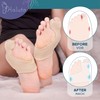 HALUTO Pack of 2 Hallux Valgus Correction Bandage - Toe