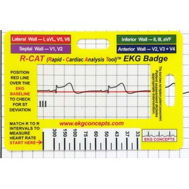 R-CAT EKG Badge