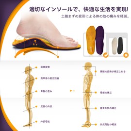 Insole, Insole, Shock Absorption, Flat Feet, Insole, Shock Absorption, Size Adjustment, Metatarsal Pad, Heel, Arch and Valgus Foot, Standing Work, Plantar Fasciitis, Supporter, Leg Correction, Sukutei