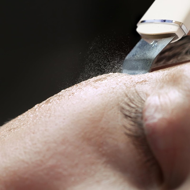 Rio Ultrasonic Skin Cleanser