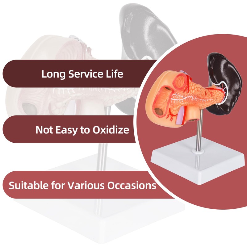 Simedutech Pancreas Spleen Anatomy Model, Normal