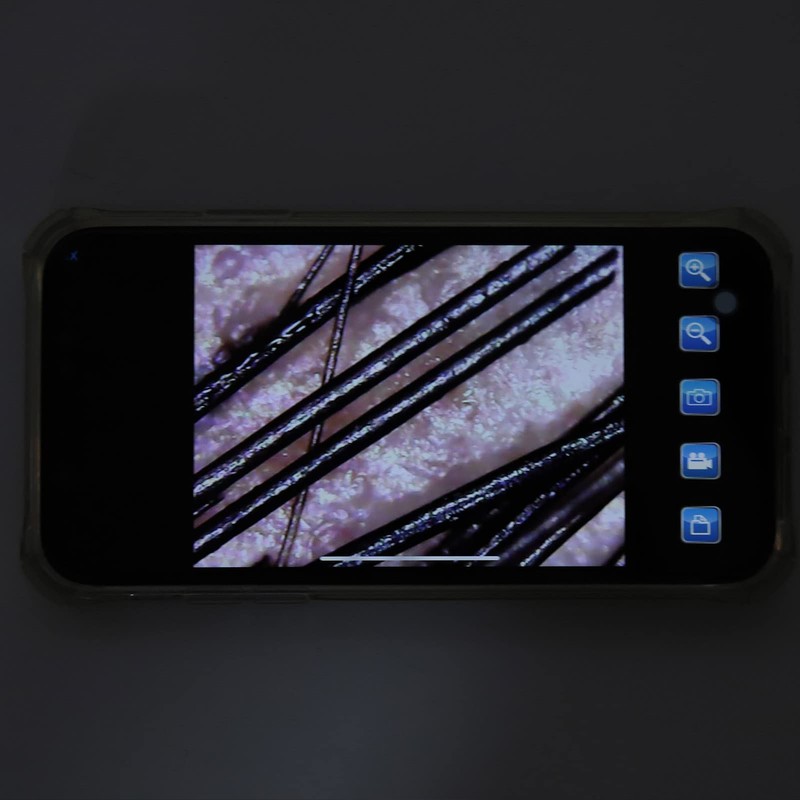 Scalp Detector, 800X Clear Image Hair Folicle Health Analyzer, Hair