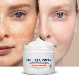 Grospe Urea Cream 40 Percent,Foot & Hand 40% Urea Cream for Dry Cracked Heels Feet Knees Elbows Hands Softening Heel Skin Repair Moisturizer Cream 5.29 OZ