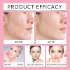 Sérum Facial Azelaico 15% Anti-projeces Cuidado Piel 20g