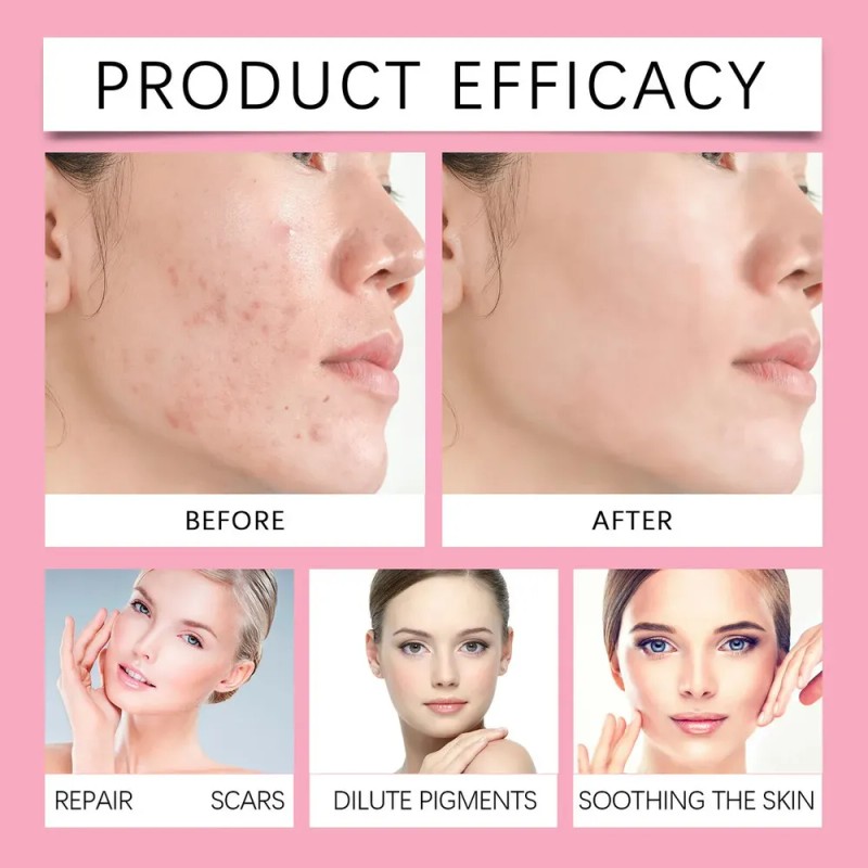 Sérum Facial Azelaico 15% Anti-projeces Cuidado Piel 20g