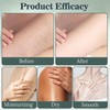 Intertrigo Cream, Skin Fold Care & Chafing Support Cream, Helps