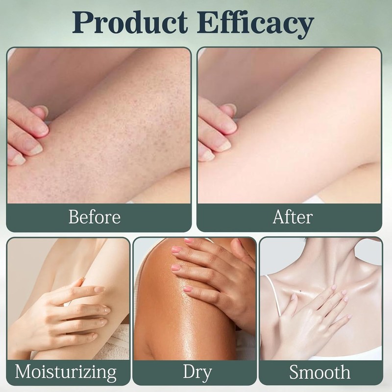 Intertrigo Cream, Skin Fold Care & Chafing Support Cream, Helps