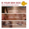 Crema For Eliminar Manchas Oscuras Y Manchas For Melasma Y