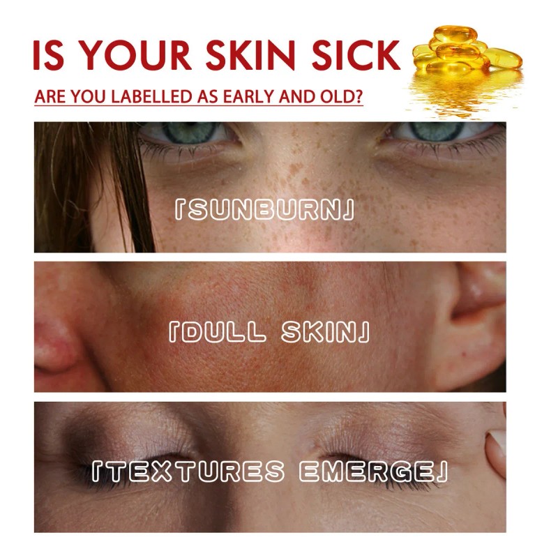 Crema For Eliminar Manchas Oscuras Y Manchas For Melasma Y