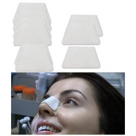 Thermoplastic Nasal Splints, External Nose Support Protector for Rhinoplasty Septoplasty Surgery, Nose Brace Fracture, ENT, Orthopedic Immobilization, 50pcs-S, (B)