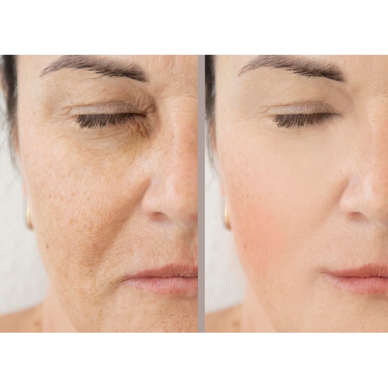 Vitality Precision Skin Niacinamide+ Zinc High potency brightening and pore