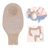 Colostomy Bag Nonwoven ABS Leak Proof Portable Ostomy Pouch for