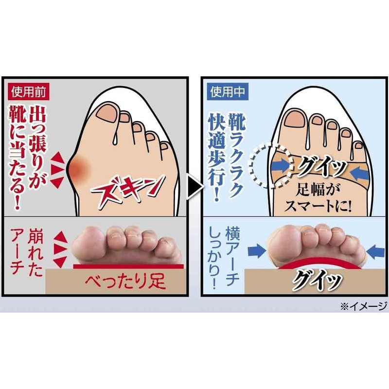 [PLUS Walk] Bunions a-tiguitto Pack of 12 