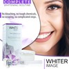 Whiter Image Deluxe Teeth Whitening Kit to Eliminate Teeth Discoloration