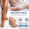 Urea Cream - Foot Cream for Cracked Heels and Dry