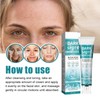 Aufhellende Sommersprossen Creme,Dark Spot Remove,Anti-Freckle Niacinamide Cream,Neu Skin Whitening Cream