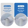 TEOZBLU Pack of 8 Heating Pipe Rosette, Inner Diameter 17