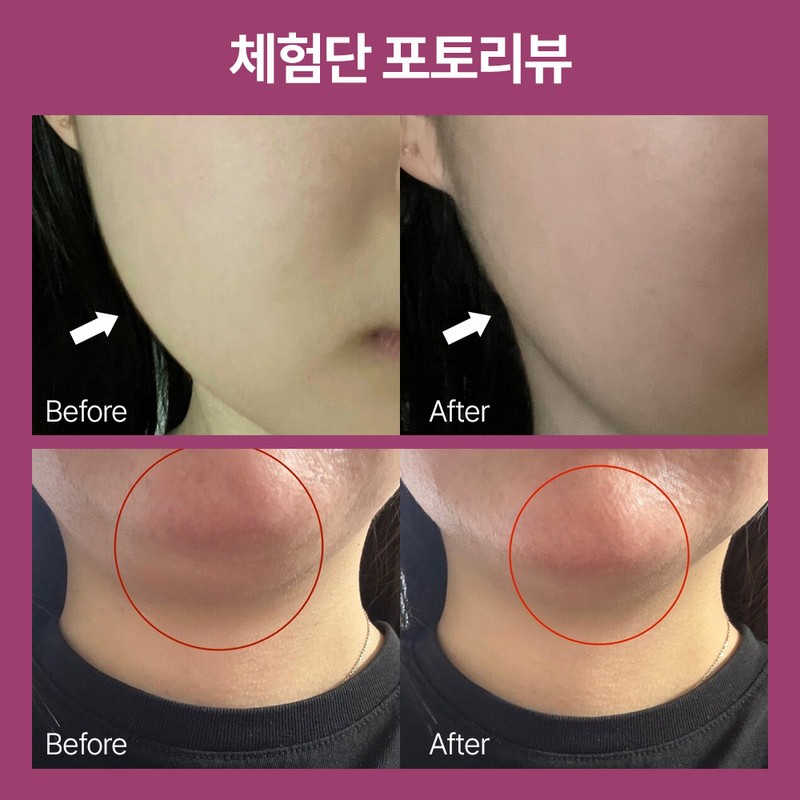 The Medi Doctor Double chin guasha massage / Shrink cream