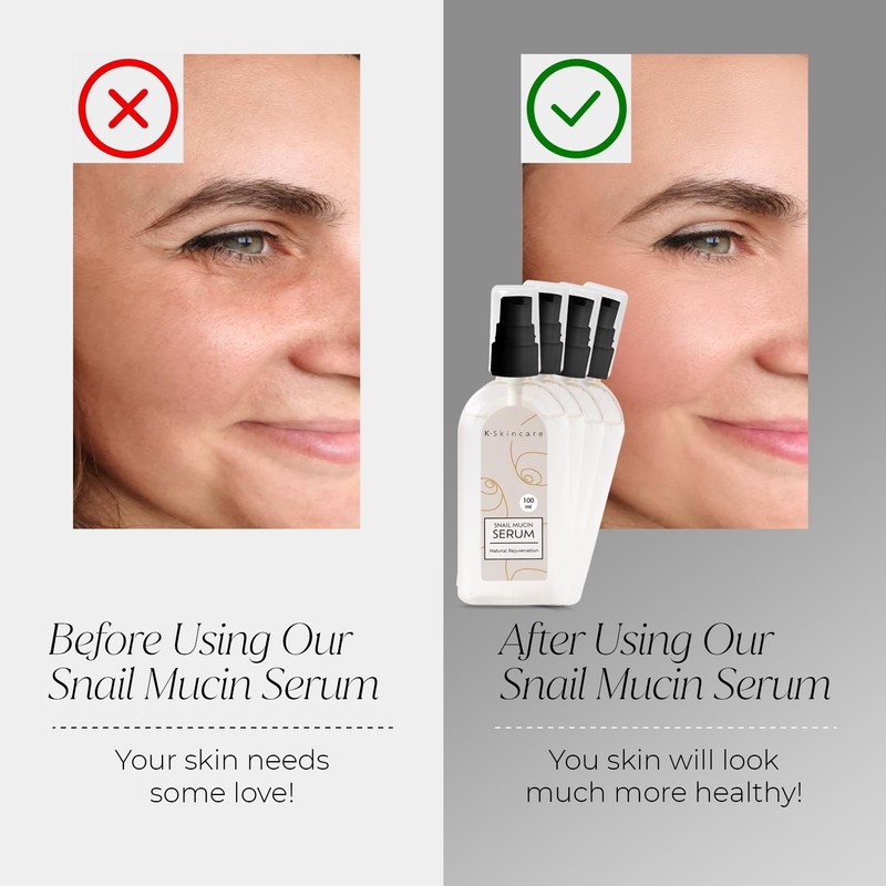 x4 Snail Mucin Essence Serum & Hyaluronic Acid - All