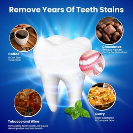 Tiras Blanqueadoras Dientes,Whitening Strips Sensitive,28 unidades Tiras Blanqueadoras Dentales,14 Sesiones Blanqueamiento Dental Seguro para Elimina eficazmente años de manchas duras de café,vino y dientes