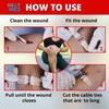 NEXT LEVEL MED Steri-Stitch Wounds & Cuts Closure Kit -