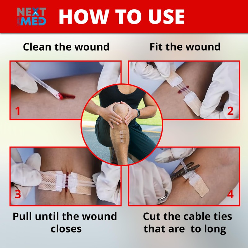 NEXT LEVEL MED Steri-Stitch Wounds & Cuts Closure Kit -