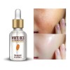 MOLIN SERUM Suero Serum De Arroz Antiarrugas Hidratante Humectante