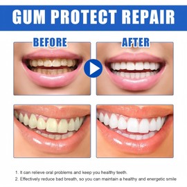 Teeth Repair Gel,Gum Protect Repair Gel,Gum Repair for Receding Gums,Bleeding Gums Treatment,Receding Gum Treatment,Teeth Whitening Essence,Deeply Cleaning & Fresh Breath,Improve Oral Problems