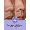 Nose Pore Patches Trio – Deep Cleansing Blackhead Remover Strips,