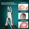 DEOU Heavy Duty Large Opening toenail Clippers, Suitable for Embedded